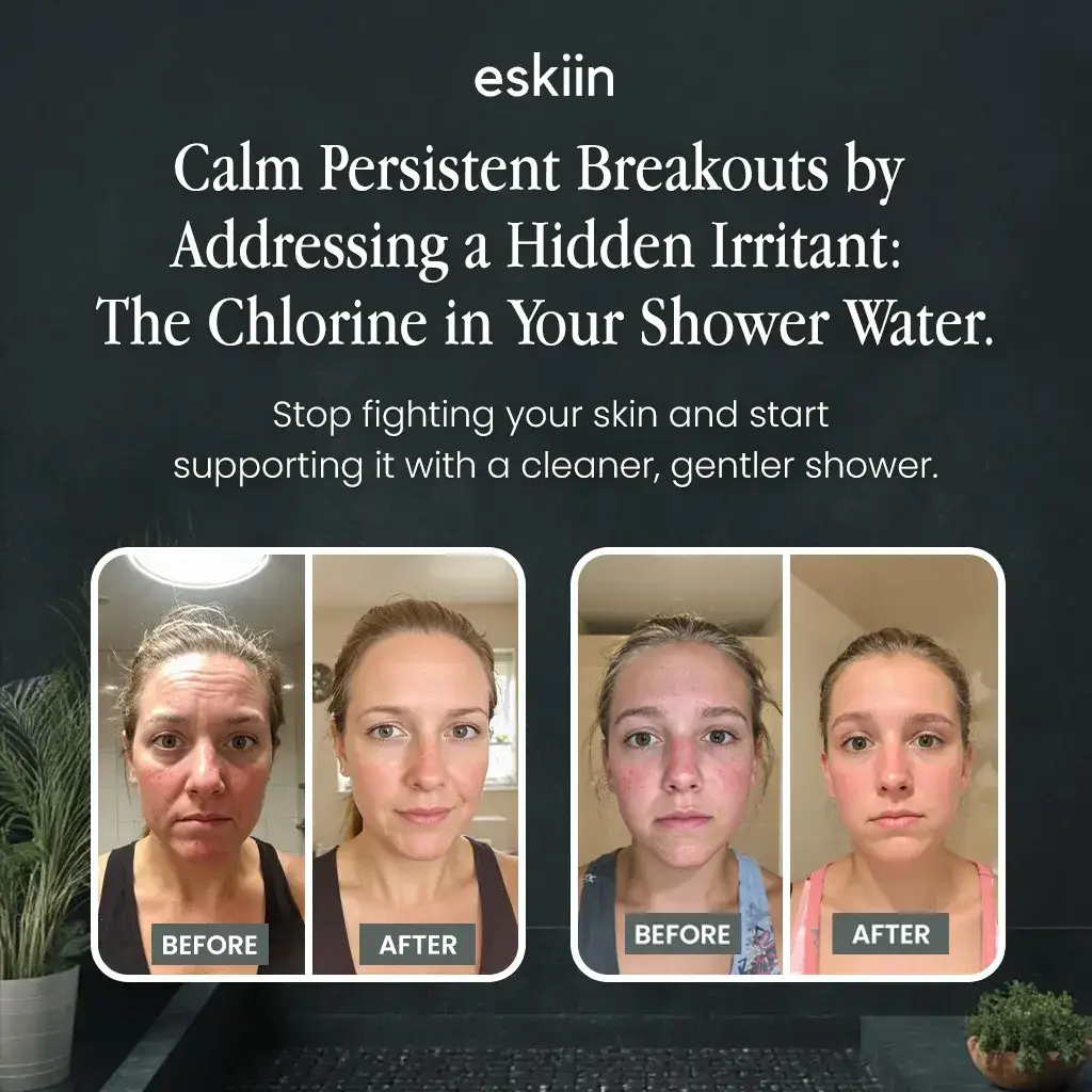 Filtered Showerhead - Healthier Shower Experience