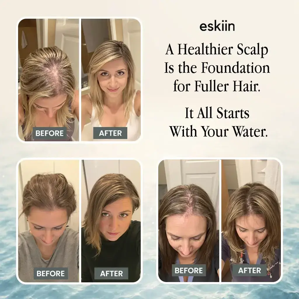 Filtered Showerhead - Healthier Shower Experience