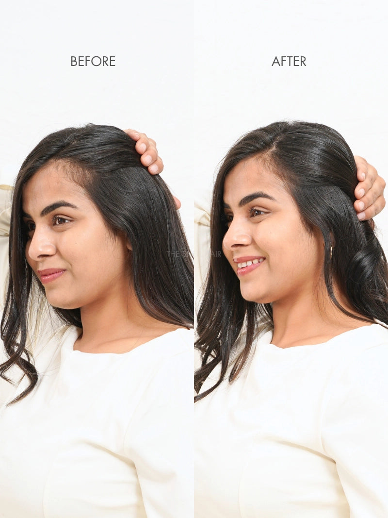 Seamless Blind Patch-Cover-up Patch-Straight